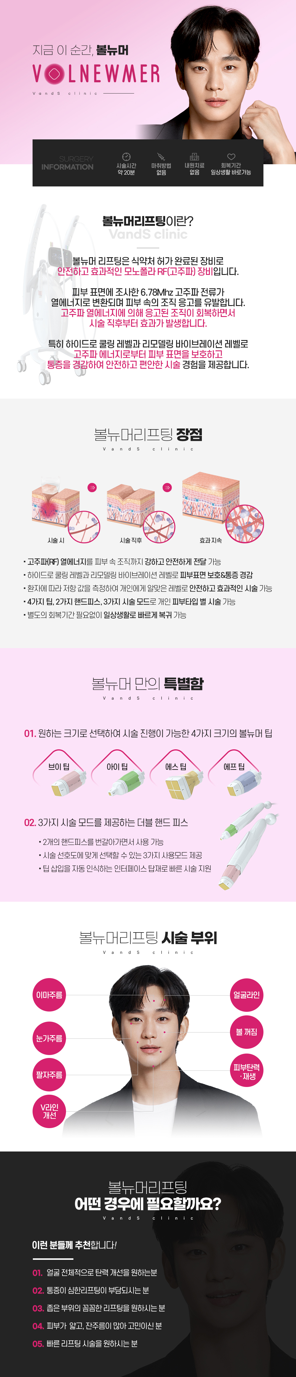 볼뉴머 시술안내 이미지1